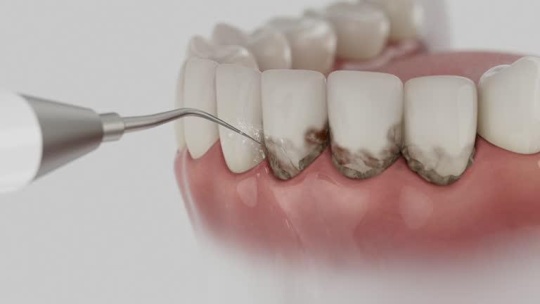 Trusted Teeth Cleaning And Checkup service in Whitney, TX - Dentist Open Now
